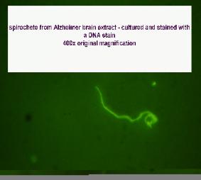 Click in image to see discussion of Spirochetal hieroglyphics and to see more spirochetes cultured from Alzheimer brain tissue