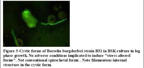 Cystic spirochetal forms are not Just Resting - they are agents of nerve injury