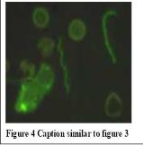 Cystic spirochete at 7 oclock,  Conventional corkscrew forms (2)