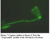 Cystic forms and Corkscrew forms interconvert