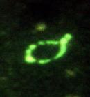 Ring Forms are part of the Morphologic Diversity of Spirochetes - Borrelia and Treponema both demonstrate ring forms