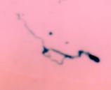 Spirochete stained with Silver from Brain of baby who Died from SIDS - Sudden Infant death Syndrome